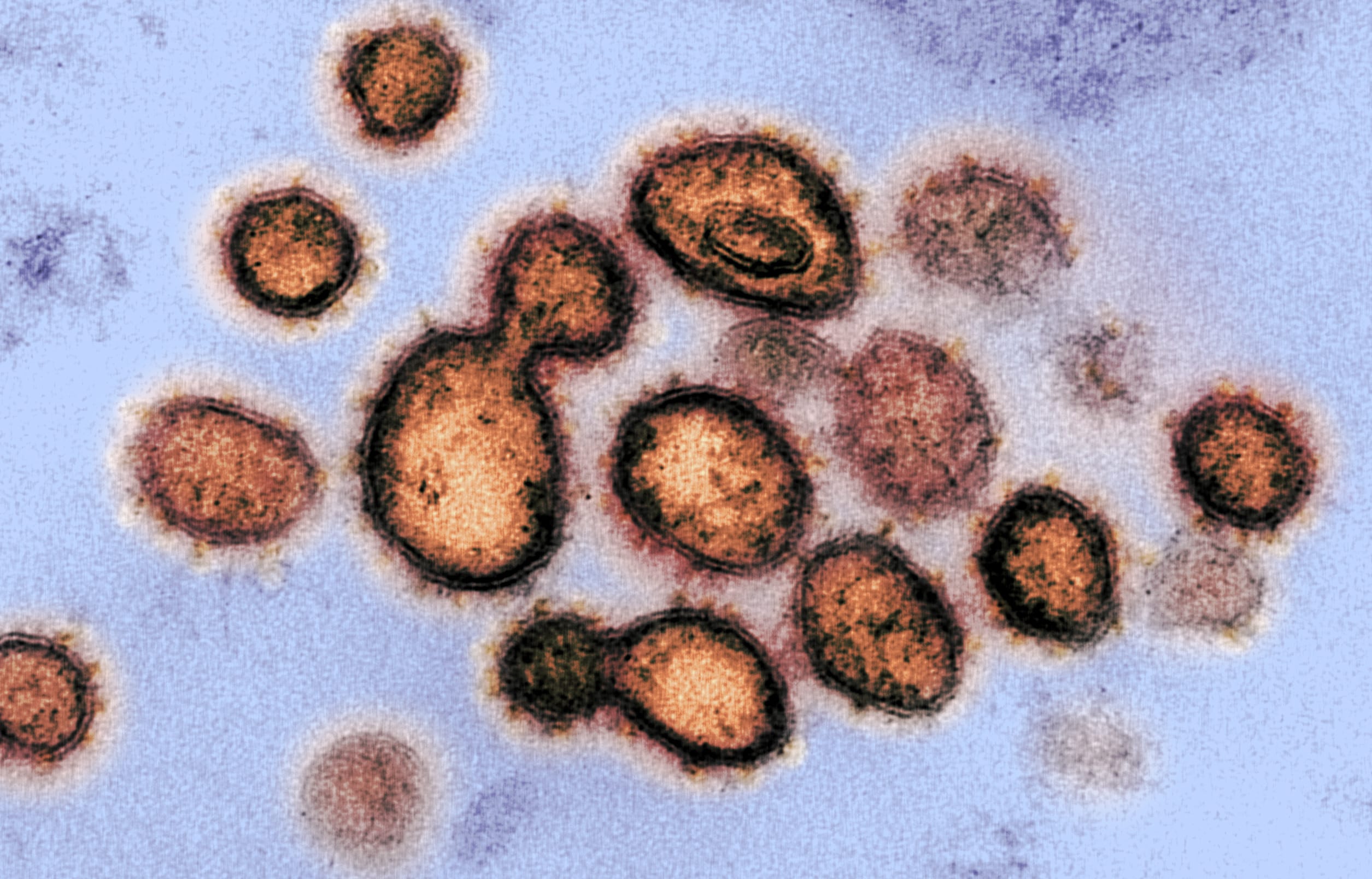 Brasil confirma primeiro caso de reinfecção por Covid-19